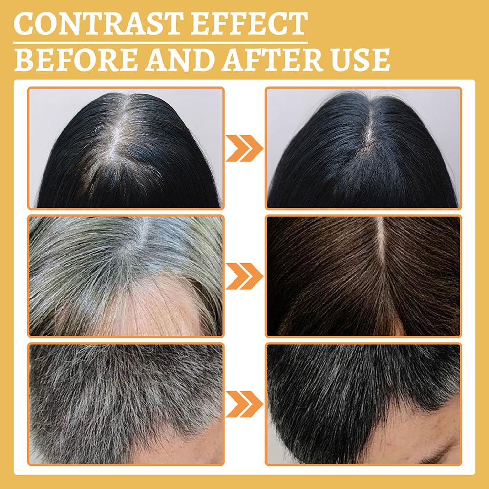 1/2PCS Suero para el Crecimien - Growth Factor Serum reseña y precio