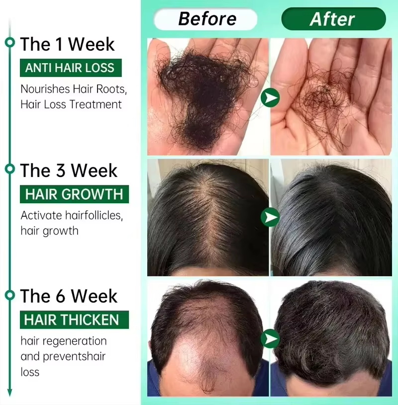 Suero para el crecimiento del  - Growth Factor Serum reseña y precio